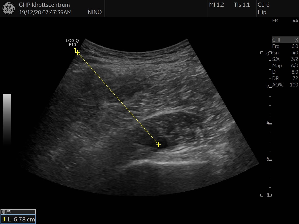 Patient case hip 1