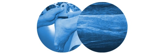 scanning ultrasound